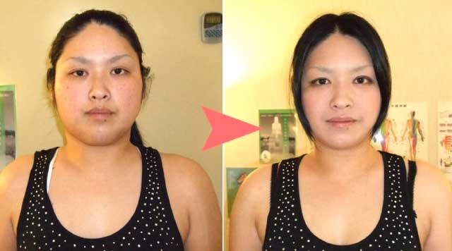 藤枝 ダイエット整体