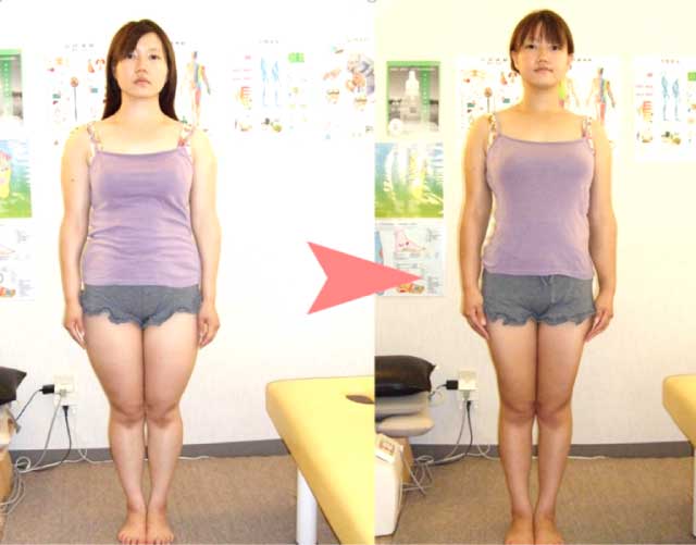 藤枝 ダイエット整体