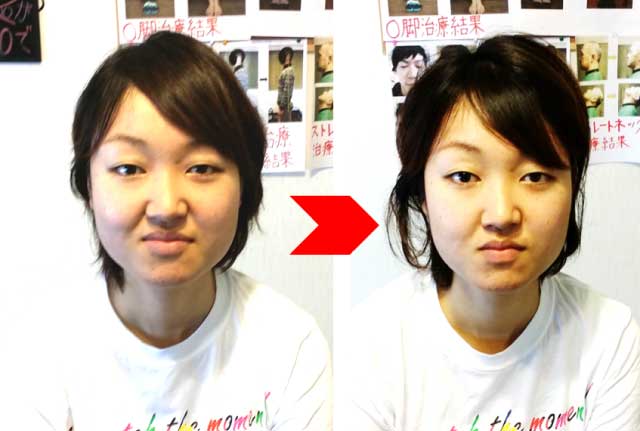 藤枝 ダイエット整体