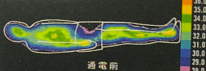 藤枝 ダイエット整体