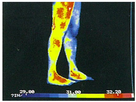 藤枝 ダイエット整体