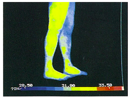 藤枝 ダイエット整体